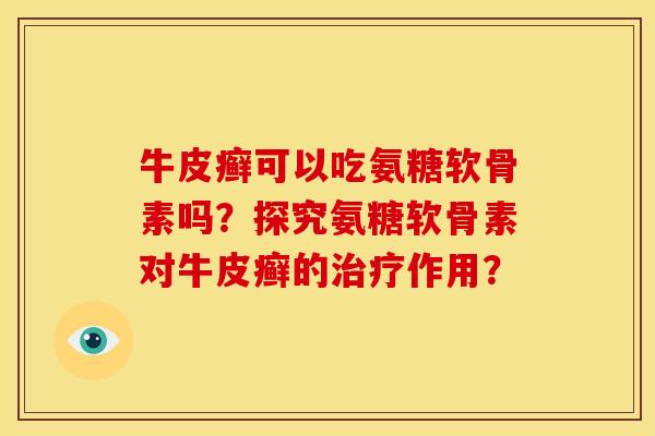 牛皮癣可以吃氨糖软骨素吗?探究氨糖软骨素对牛皮癣的作用? 牛皮癣可以吃氨糖软骨素吗?探究氨糖软骨素对牛皮癣的作用?