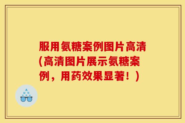 服用氨糖案例图片高清(高清图片展示氨糖案例，用果显著！)