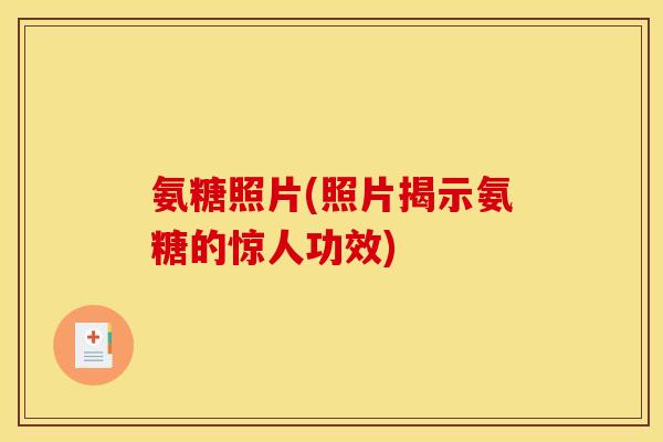 氨糖照片(照片揭示氨糖的惊人功效)