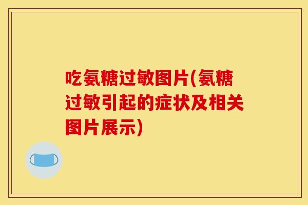 吃氨糖过敏图片(氨糖过敏引起的症状及相关图片展示)