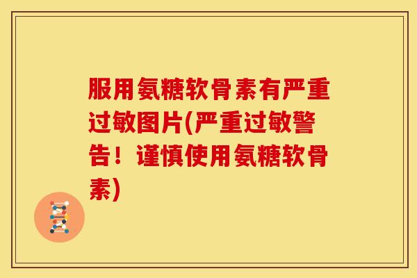 服用氨糖软骨素有严重图片(严重警告!谨慎使用氨糖软骨素) 服用氨糖软骨素有严重图片(严重警告!谨慎使用氨糖软骨素)