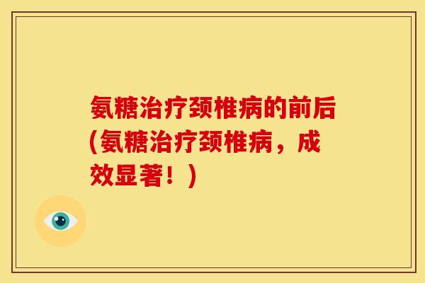 氨糖颈椎的前后(氨糖颈椎,成效显著!) 氨糖颈椎的前后(氨糖颈椎,成效显著!)
