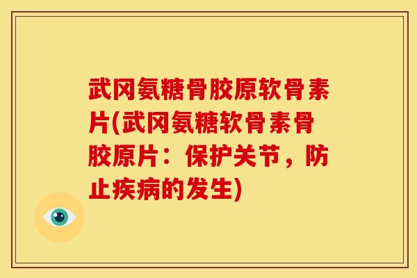 武冈氨糖骨胶原软骨素片(武冈氨糖软骨素骨胶原片：保护关节，防止疾病的发生)