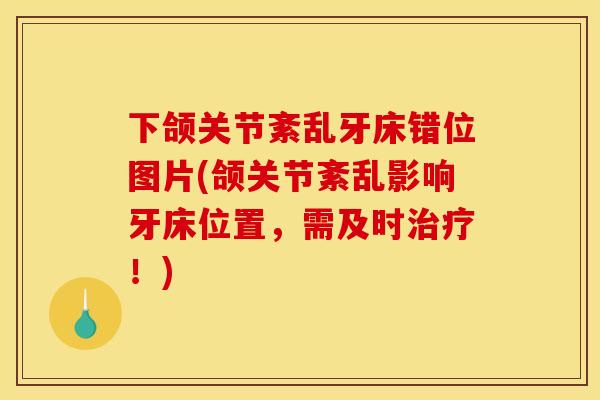 下颌关节紊乱牙床错位图片(颌关节紊乱影响牙床位置,需及时!) 下颌关节紊乱牙床错位图片(颌关节紊乱影响牙床位置,需及时!)