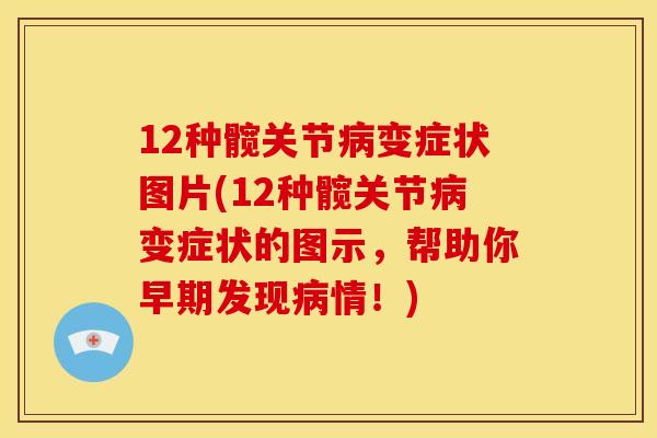 12种髋关节病变症状图片(12种髋关节病变症状的图示，帮助你早期发现病情！)