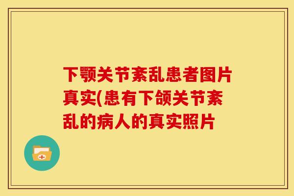 下颚关节紊乱患者图片真实(患有下颌关节紊乱的病人的真实照片