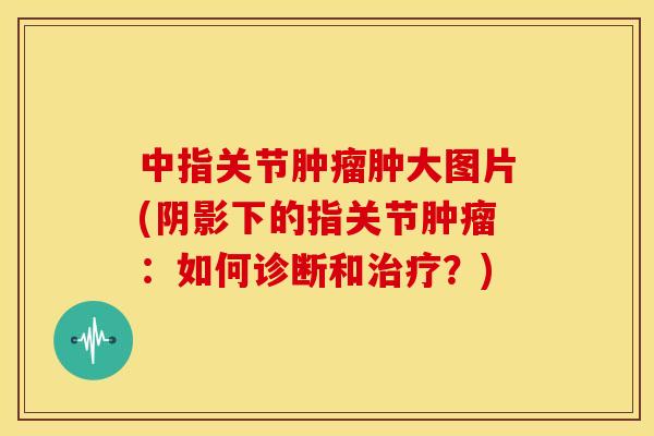 中指关节肿瘤肿大图片(阴影下的指关节肿瘤：如何诊断和治疗？)