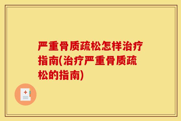 严重怎样指南(严重的指南) 严重怎样指南(严重的指南)