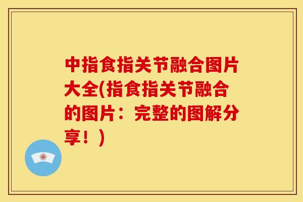 中指食指关节融合图片大全(指食指关节融合的图片：完整的图解分享！)