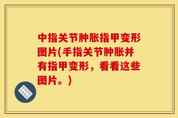 中指关节肿胀指甲变形图片(手指关节肿胀并有指甲变形，看看这些图片。)