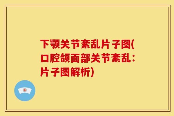 下颚关节紊乱片子图(口腔颌面部关节紊乱:片子图解析) 下颚关节紊乱片子图(口腔颌面部关节紊乱:片子图解析)