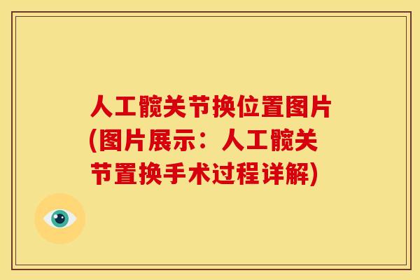 人工髋关节换位置图片(图片展示：人工髋关节置换手术过程详解)