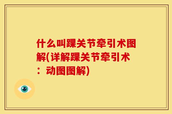 什么叫踝关节牵引术图解(详解踝关节牵引术:动图图解) 什么叫踝关节牵引术图解(详解踝关节牵引术:动图图解)