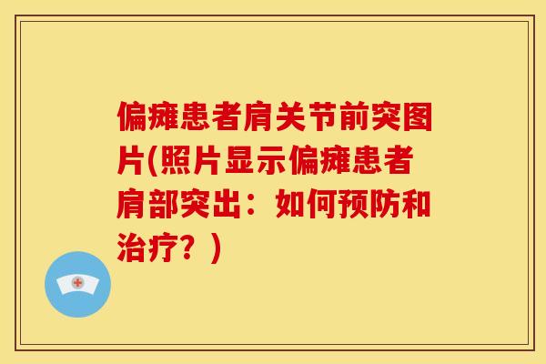 偏瘫患者肩关节前突图片(照片显示偏瘫患者肩部突出：如何和？)