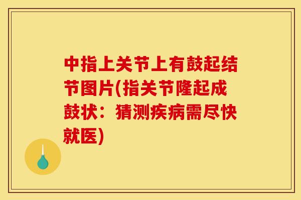 中指上关节上有鼓起结节图片(指关节隆起成鼓状:猜测需尽快就医) 中指上关节上有鼓起结节图片(指关节隆起成鼓状:猜测需尽快就医)