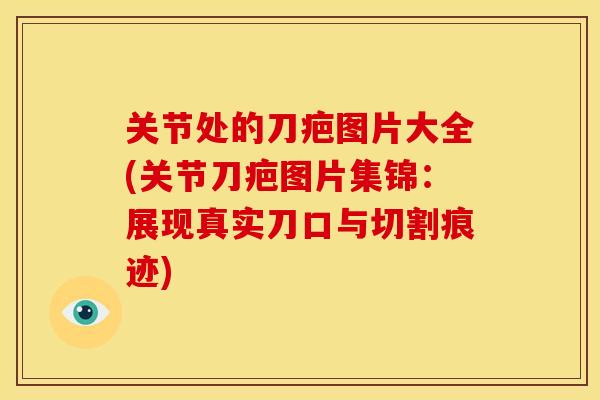 关节处的刀疤图片大全(关节刀疤图片集锦：展现真实刀口与切割痕迹)
