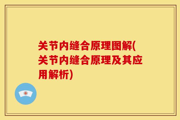 关节内缝合原理图解(关节内缝合原理及其应用解析)