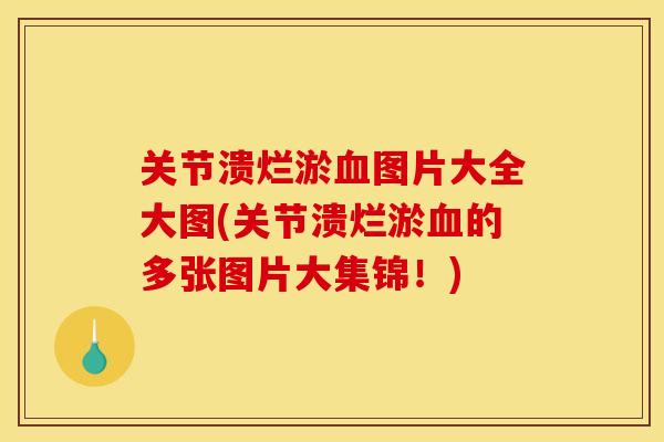关节溃烂淤血图片大全大图(关节溃烂淤血的多张图片大集锦！)
