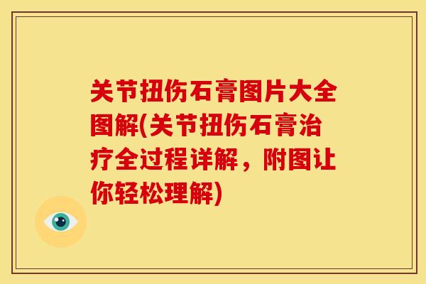 关节扭伤石膏图片大全图解(关节扭伤石膏治疗全过程详解，附图让你轻松理解)
