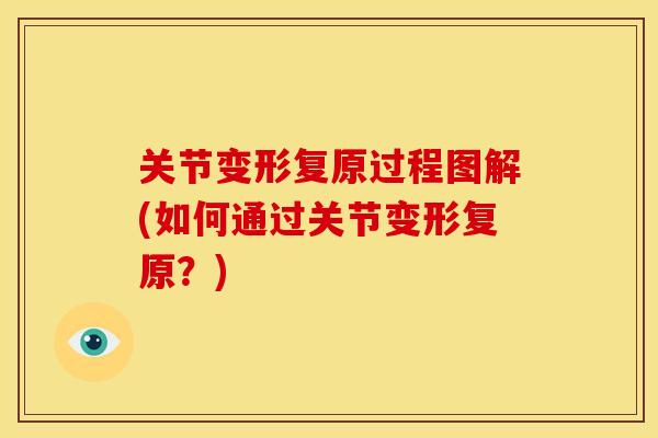 关节变形复原过程图解(如何通过关节变形复原？)