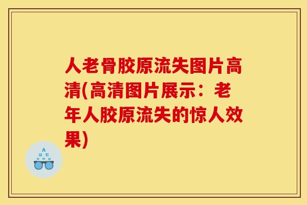 人老骨胶原流失图片高清(高清图片展示：老年人胶原流失的惊人效果)