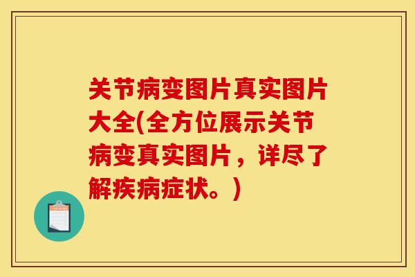 关节病变图片真实图片大全(全方位展示关节病变真实图片，详尽了解疾病症状。)