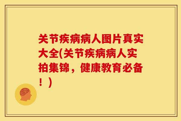 关节疾病病人图片真实大全(关节疾病病人实拍集锦，健康教育必备！)