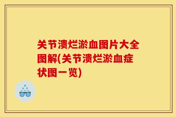 关节溃烂淤血图片大全图解(关节溃烂淤血症状图一览)