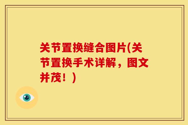 关节置换缝合图片(关节置换手术详解，图文并茂！)