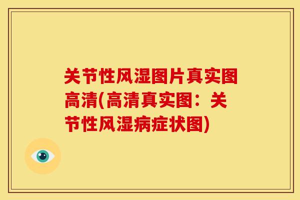 关节性风湿图片真实图高清(高清真实图：关节性风湿病症状图)
