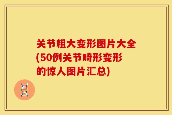 关节粗大变形图片大全(50例关节畸形变形的惊人图片汇总)