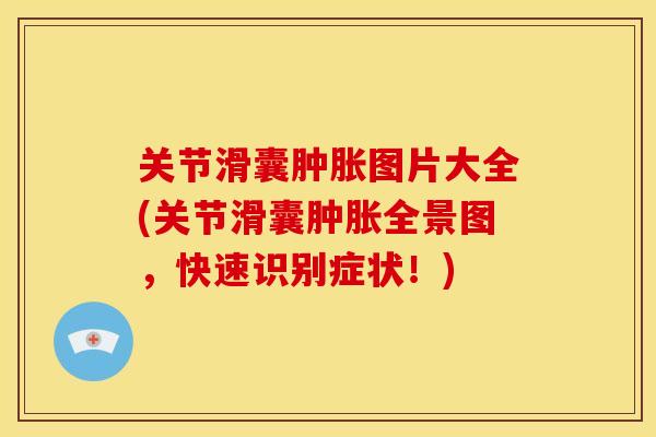 关节滑囊肿胀图片大全(关节滑囊肿胀全景图，快速识别症状！)
