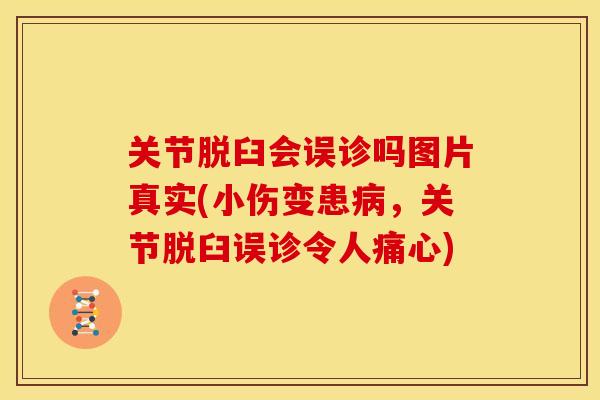 关节脱臼会误诊吗图片真实(小伤变患病，关节脱臼误诊令人痛心)