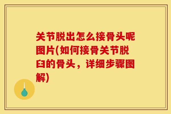 关节脱出怎么接骨头呢图片(如何接骨关节脱臼的骨头，详细步骤图解)