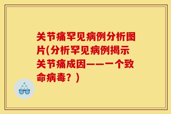 关节痛罕见病例分析图片(分析罕见病例揭示关节痛成因——一个致命病毒？)