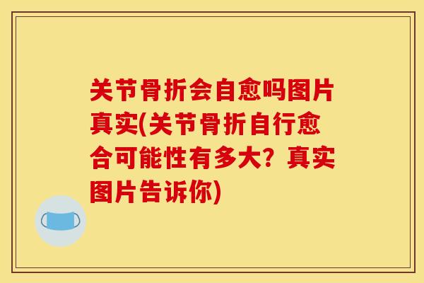 关节骨折会自愈吗图片真实(关节骨折自行愈合可能性有多大？真实图片告诉你)