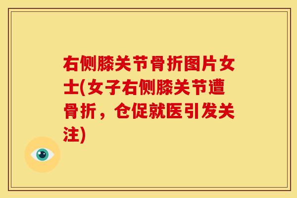右侧膝关节骨折图片女士(女子右侧膝关节遭骨折，仓促就医引发关注)