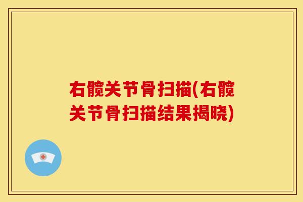 右髋关节骨扫描(右髋关节骨扫描结果揭晓)