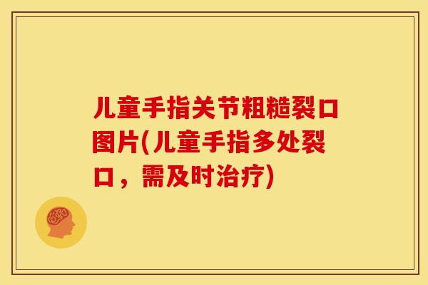 儿童手指关节粗糙裂口图片(儿童手指多处裂口,需及时) 儿童手指关节粗糙裂口图片(儿童手指多处裂口,需及时)