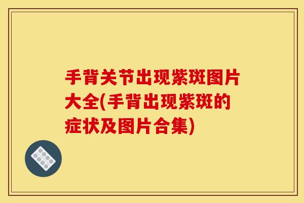 手背关节出现紫斑图片大全(手背出现紫斑的症状及图片合集)
