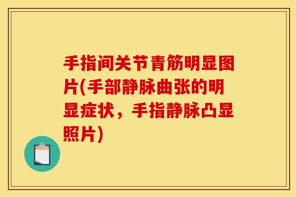 手指间关节青筋明显图片(手部静脉曲张的明显症状，手指静脉凸显照片)