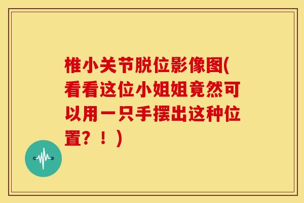 椎小关节脱位影像图(看看这位小姐姐竟然可以用一只手摆出这种位置？！)