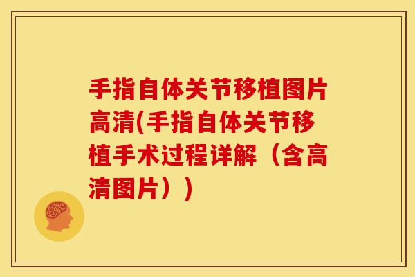 手指自体关节移植图片高清(手指自体关节移植手术过程详解（含高清图片）)