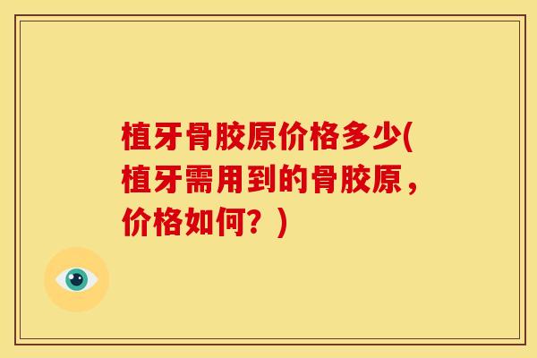 植牙骨胶原价格多少(植牙需用到的骨胶原，价格如何？)