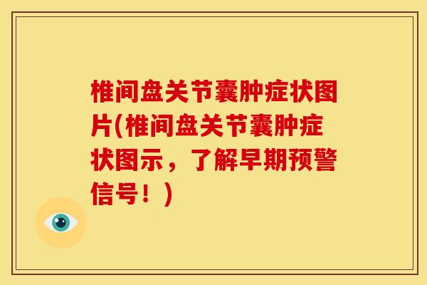 椎间盘关节囊肿症状图片(椎间盘关节囊肿症状图示，了解早期预警信号！)