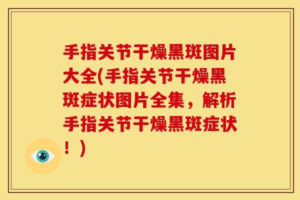 手指关节干燥黑斑图片大全(手指关节干燥黑斑症状图片全集，解析手指关节干燥黑斑症状！)