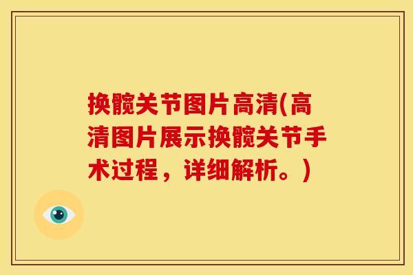 换髋关节图片高清(高清图片展示换髋关节手术过程，详细解析。)