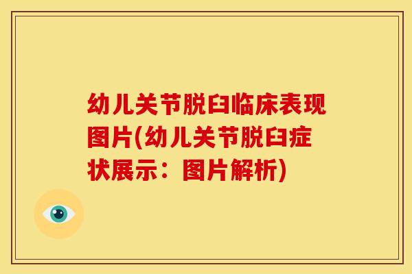 幼儿关节脱臼临床表现图片(幼儿关节脱臼症状展示:图片解析) 幼儿关节脱臼临床表现图片(幼儿关节脱臼症状展示:图片解析)