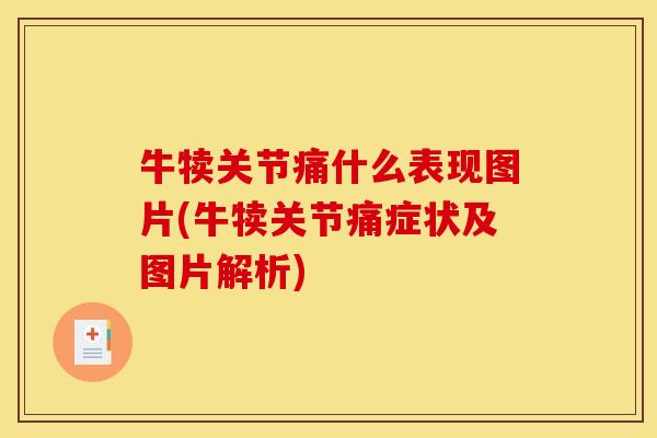 牛犊关节痛什么表现图片(牛犊关节痛症状及图片解析)