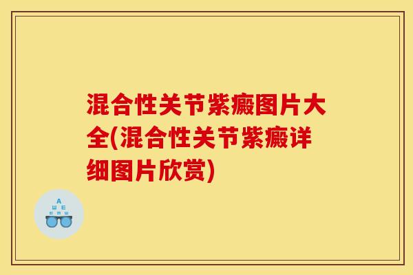 混合性关节紫癜图片大全(混合性关节紫癜详细图片欣赏)
